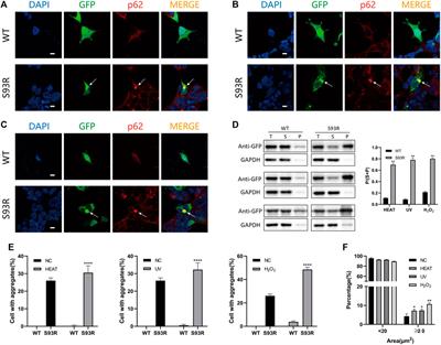 Cataract-Causing S93R Mutant Destabilized Structural Conformation of βB1 Crystallin Linking With Aggregates Formation and Cellular Viability